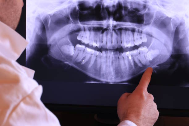 Best Emergency Dental Care for Broken or Chipped Teeth in Baraboo, WI