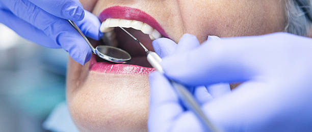 Best Emergency Tooth Extraction in Baraboo, WI